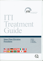 ITI Treatment Guide　Sinus Floor Elevation Procedures （DVD版）