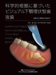 科学的根拠に基づいた ビジュアル下顎埋伏智歯抜歯