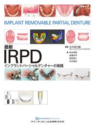 最新IRPD　 インプラントパーシャルデンチャーの実践