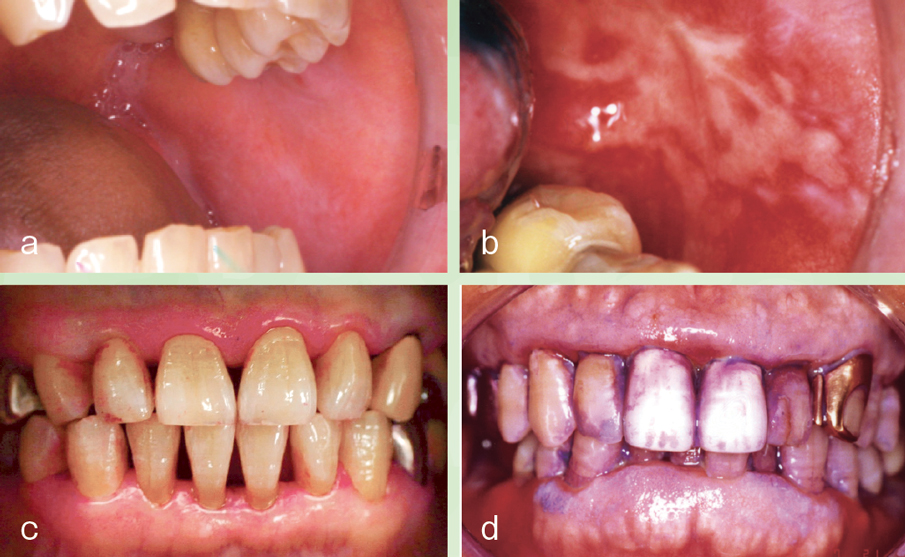 第4回：シンプルかつ効果的な医歯薬連携の取り組み