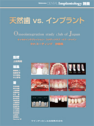 天然歯 vs.インプラント									　2011年4月