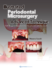 Illustrated Periodontal Microsurgery Advanced Technique