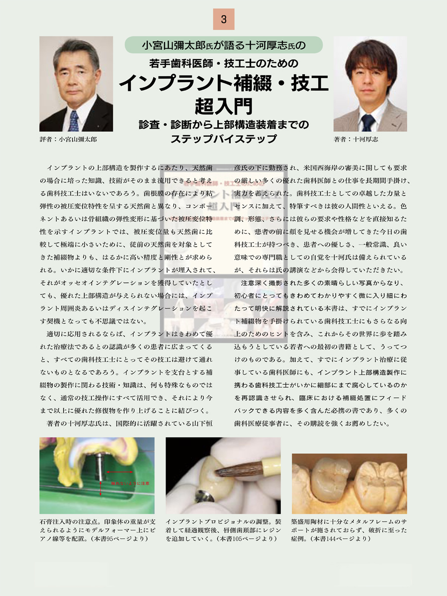 若手歯科医師・技工士のためのインプラント補綴・技工超入門