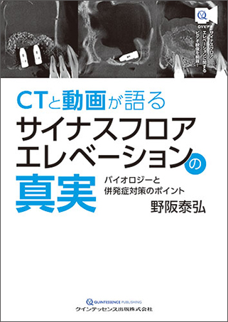 CTと動画が語る サイナスフロアエレベーションの真実