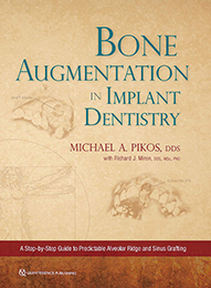 Bone Augmentation in Implant Dentistry: A Stepby-Step Guide to Predictable Alveolar Ridge and …