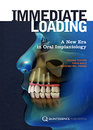 Immediate Loading：A New Era in Oral Implantology(英語版)